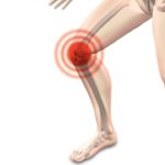 大分で注射でも良くならない膝痛が改善「大分駅前整体院」