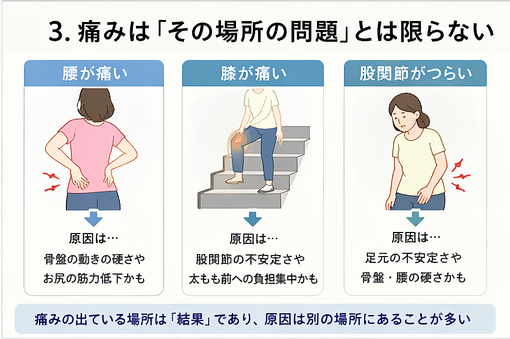 腰痛・膝痛・股関節痛は痛い場所だけが原因とは限らず、骨盤の動きや股関節の安定性、足元の不安定さが関係することを解説した図解