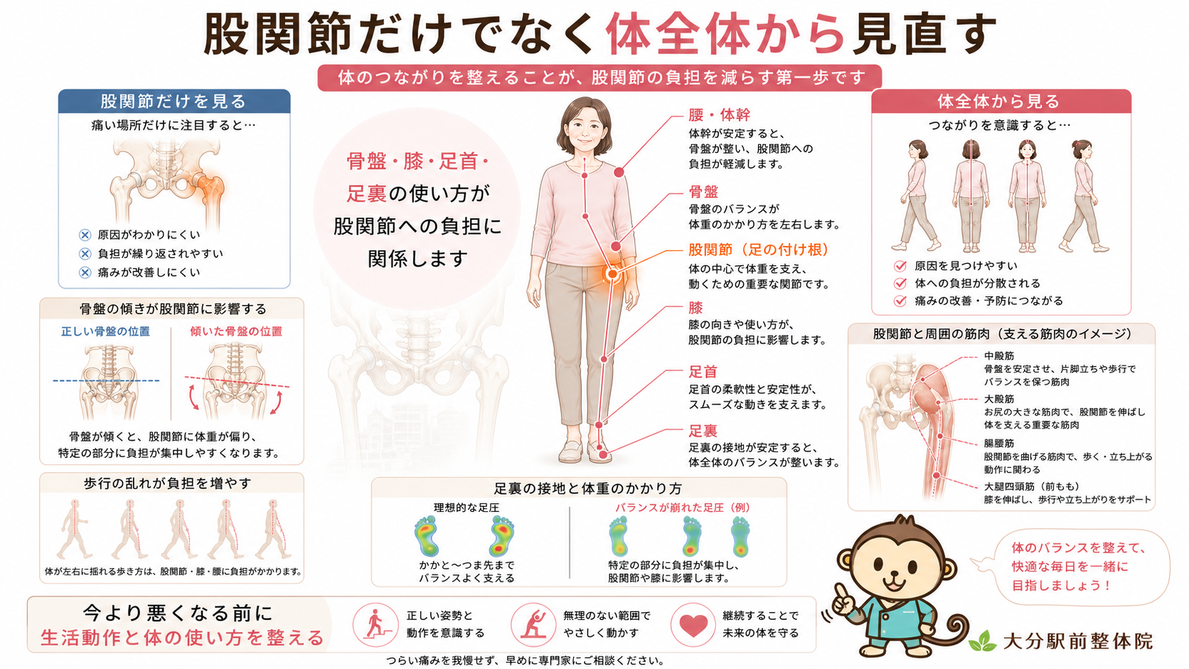 股関節だけでなく骨盤・膝・足首・足裏の使い方から生活動作を見直す重要性を示したまとめ図解