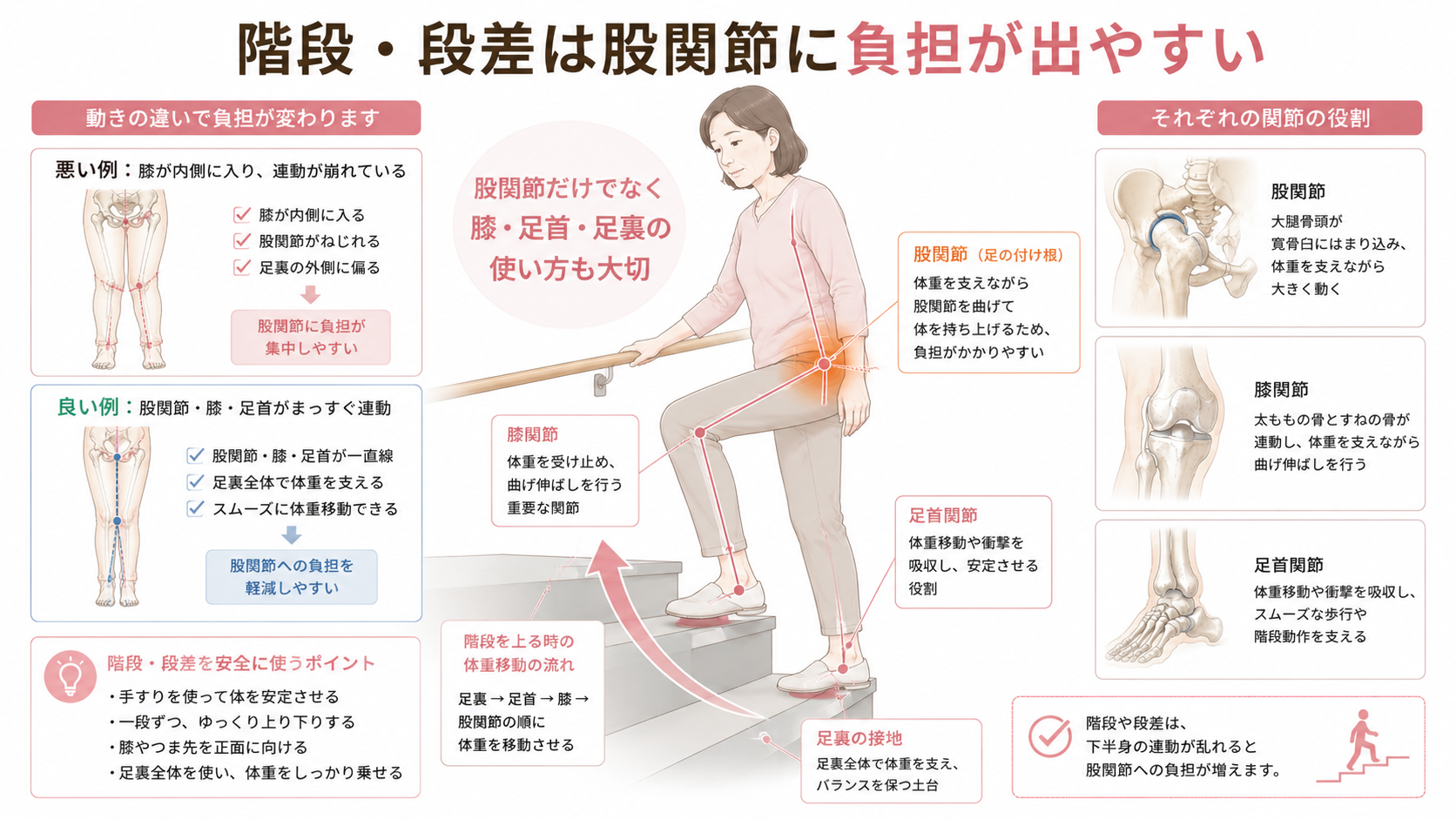 階段や段差で股関節・膝・足首・足裏が連動し、股関節に負担がかかる仕組みを示した医学図解