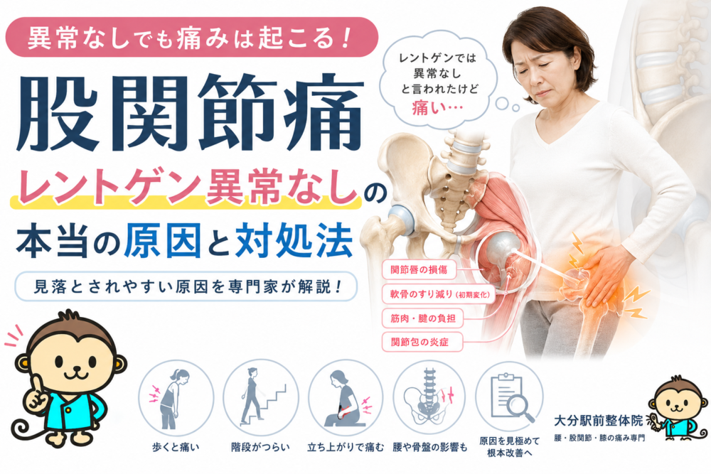 股関節痛でレントゲン異常なしと言われた方へ｜痛みの原因とは？