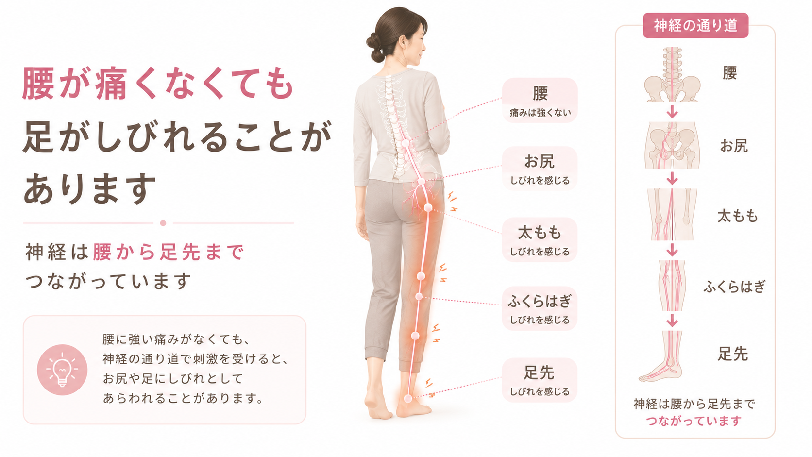 腰に強い痛みがなくても坐骨神経の通り道に沿ってお尻太ももふくらはぎ足先にしびれが出る理由を示す図解