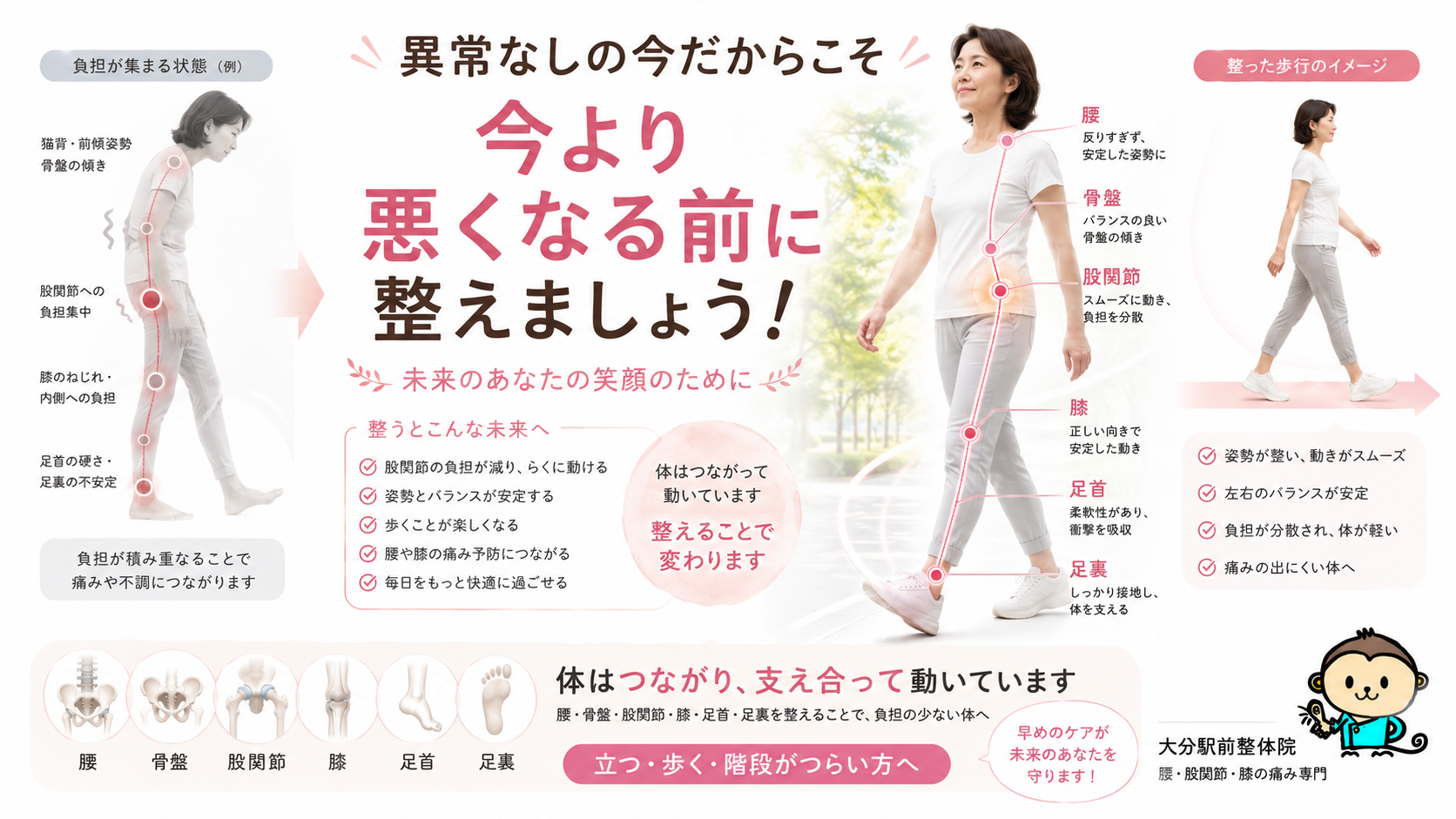 股関節痛でレントゲン異常なしの今だからこそ、腰、骨盤、股関節、膝、足首、足裏を整えて歩きやすい体を目指すまとめ図解