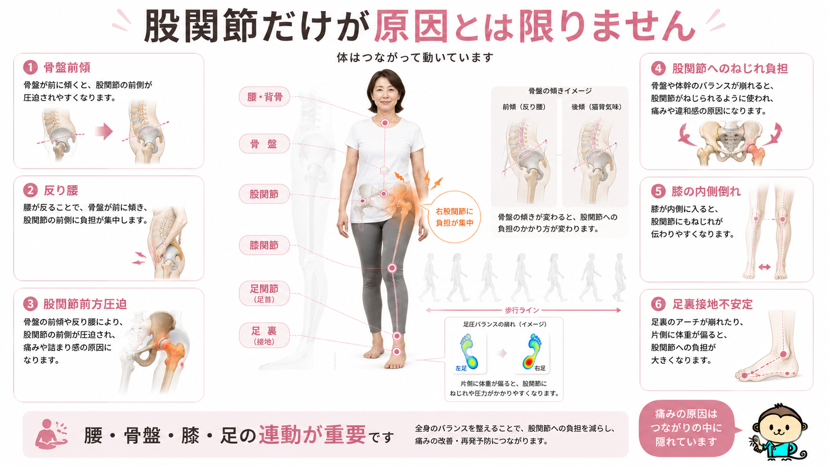 腰、骨盤、股関節、膝、足首、足裏の連動が崩れることで股関節へ負担が集まる仕組みを示した整体図解