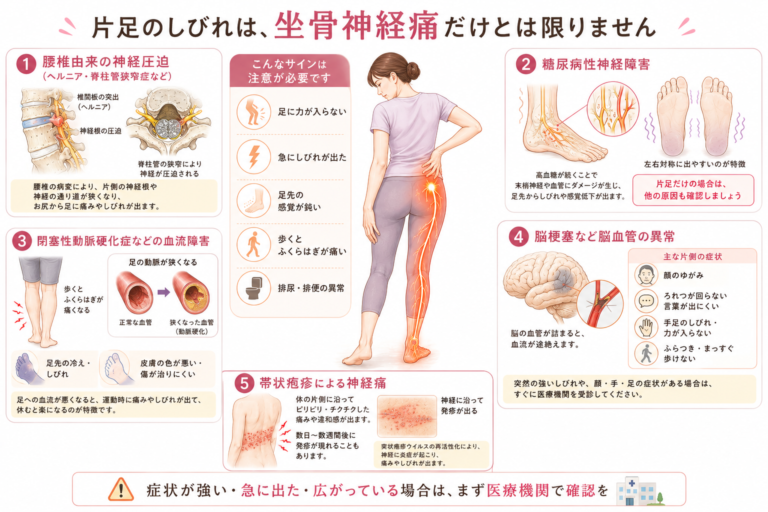 片足のしびれで注意したい腰椎由来の神経圧迫・糖尿病性神経障害・血流障害・脳血管異常・帯状疱疹を比較した図解