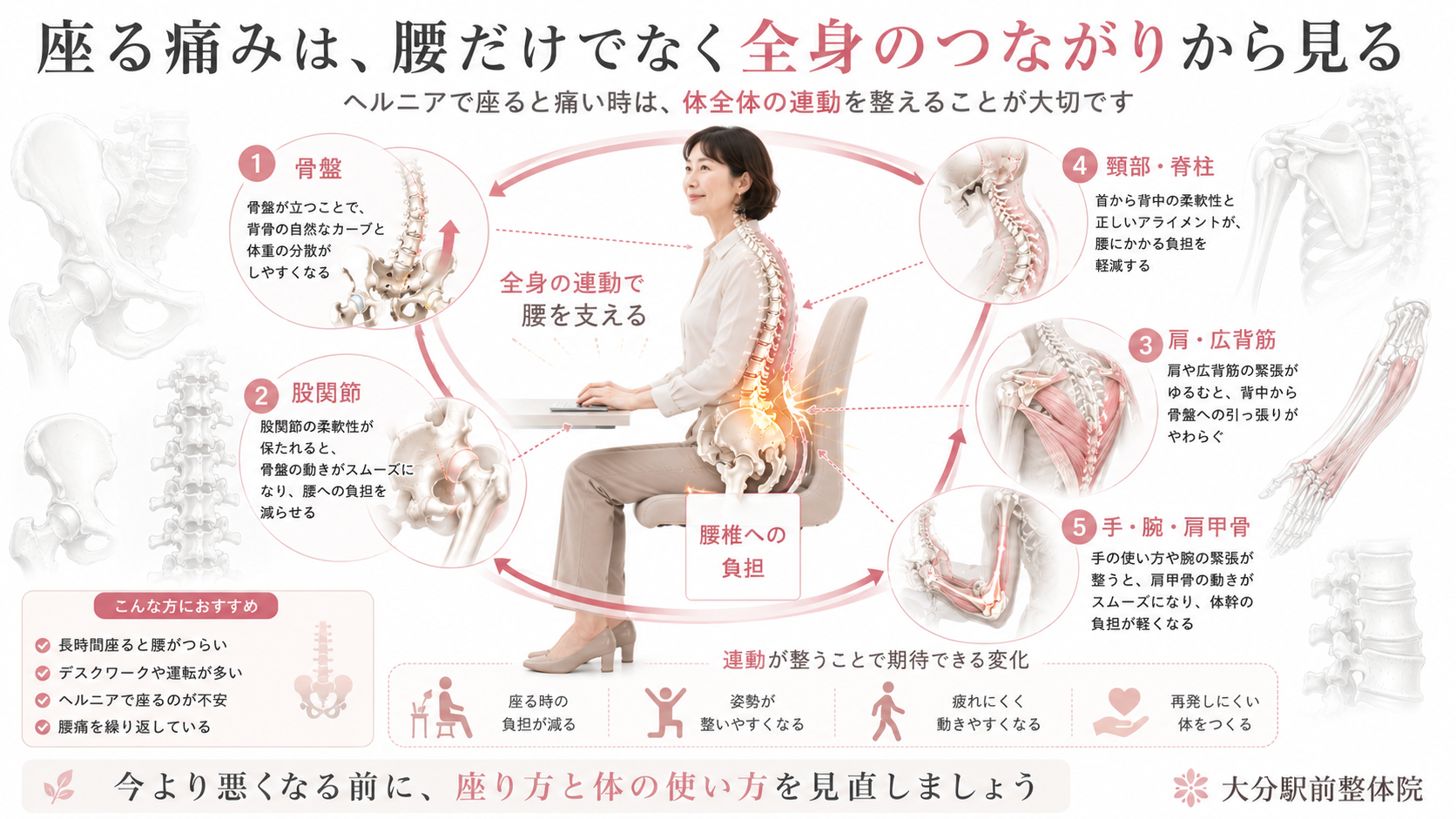 ヘルニアで座ると痛い時に、骨盤・股関節・肩・脊柱・手腕のつながりから腰への負担を見直すまとめ図解