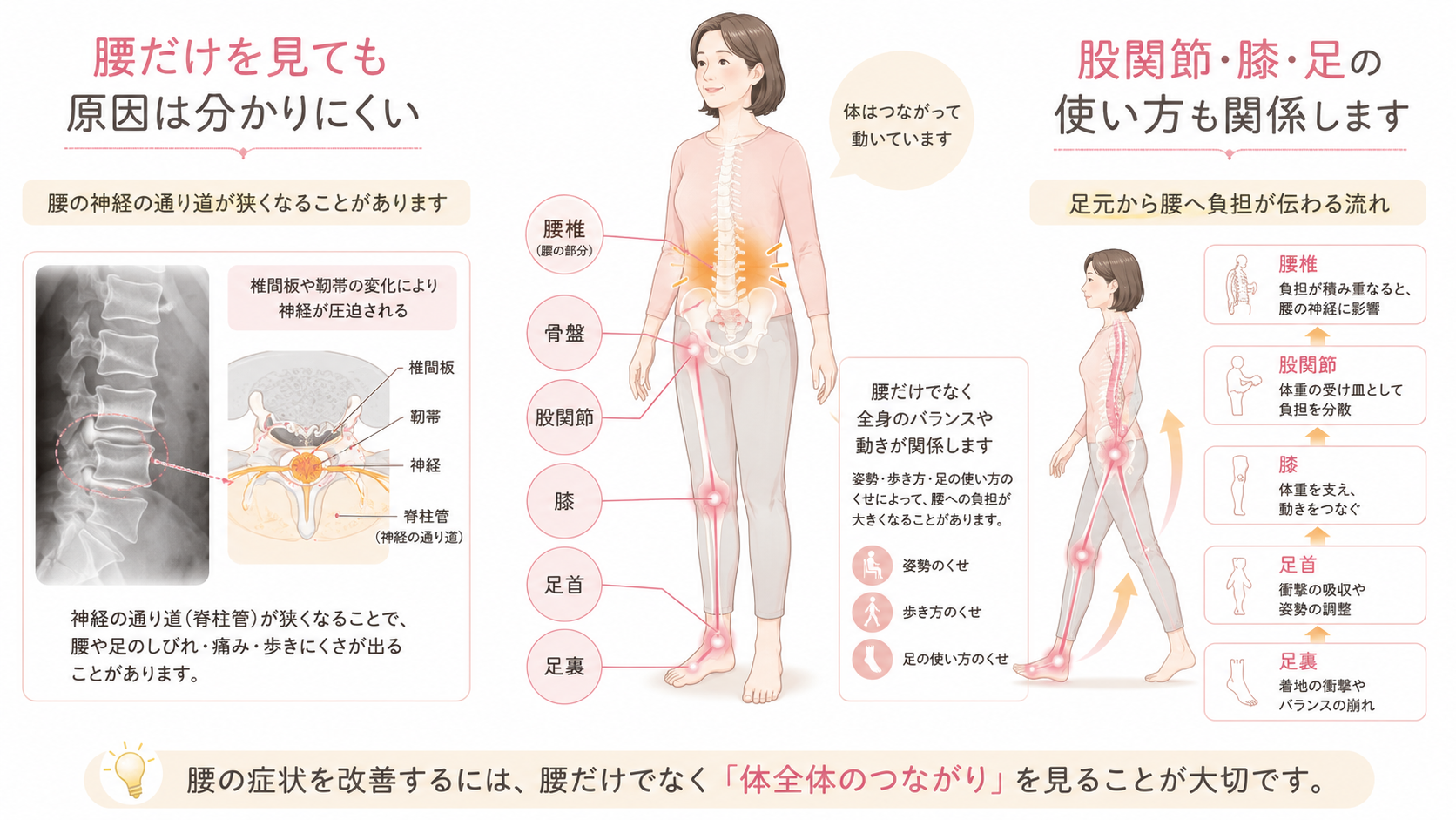 脊柱管狭窄症を腰だけでなく背骨・骨盤・股関節・膝・足首のつながりから解説した図解