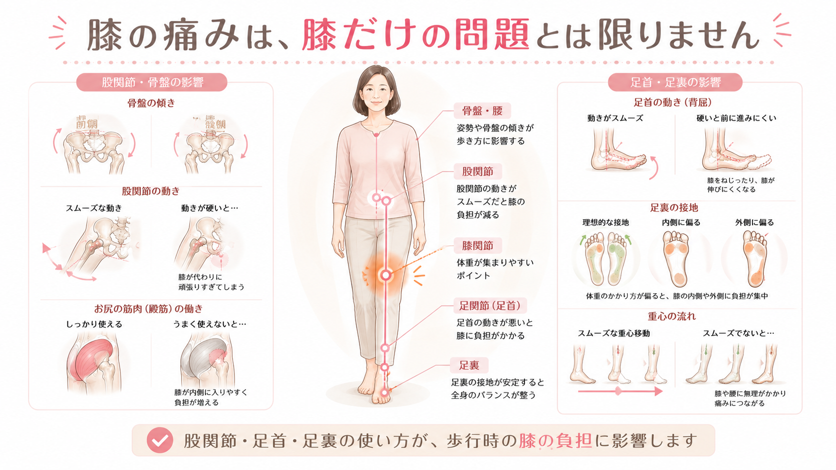 歩くと膝が痛い人が見直したい腰、骨盤、股関節、足首、足裏のつながりを示した医療整体図解