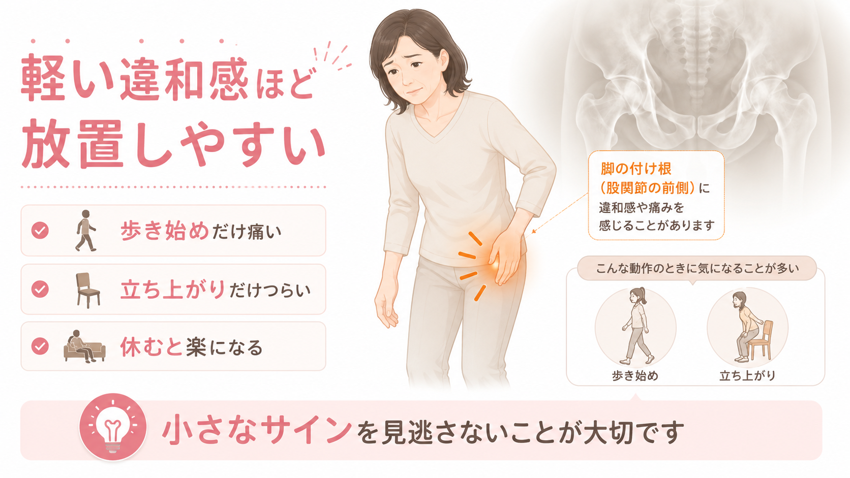 歩き始めや立ち上がりで脚の付け根に違和感を感じる女性と、変形性股関節症の初期サインを説明する図解画像