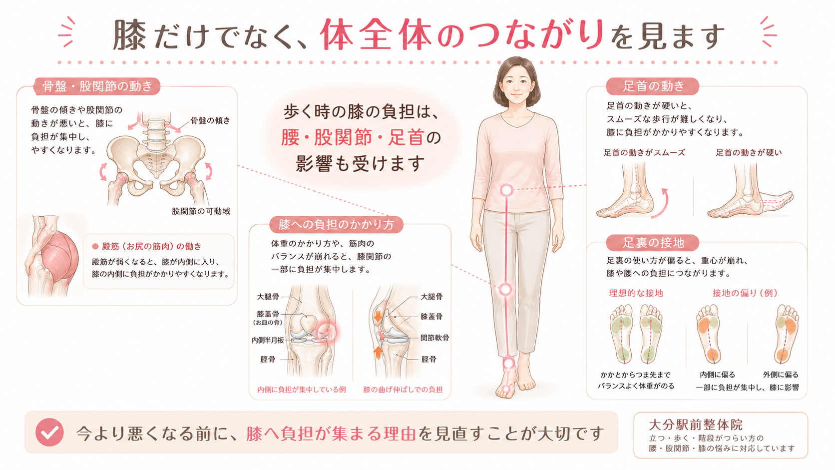 大分駅前整体院が歩くと膝が痛い方に対して腰、股関節、膝、足首、足裏のつながりを見て整える考え方を示した図解