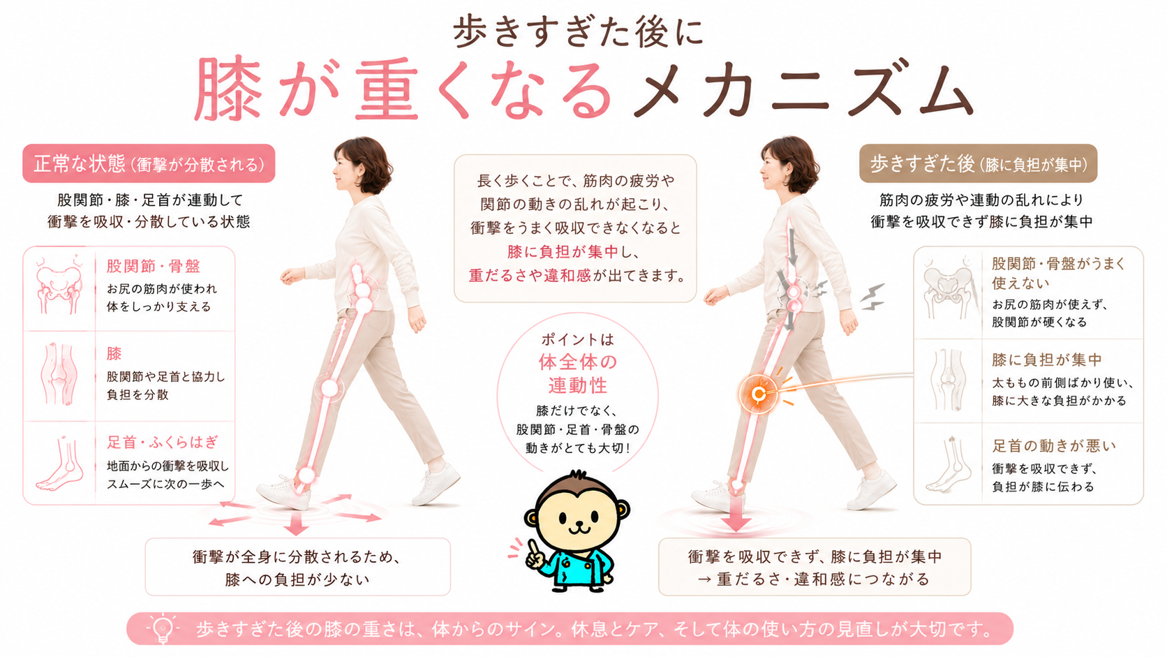 歩きすぎた後に膝が重くなる仕組みを、足首・膝・股関節・骨盤の衝撃分散と膝への負担集中で比較した図解