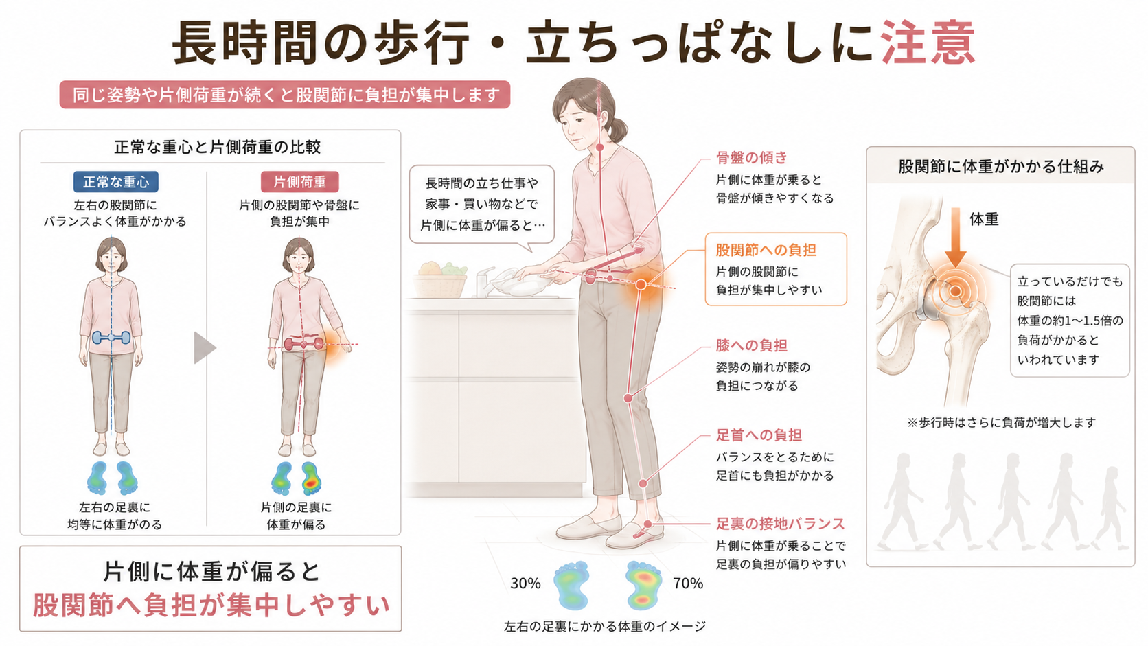 長時間の歩行や立ちっぱなしで骨盤が傾き、片側の股関節へ体重負担が集中する様子を示した図解