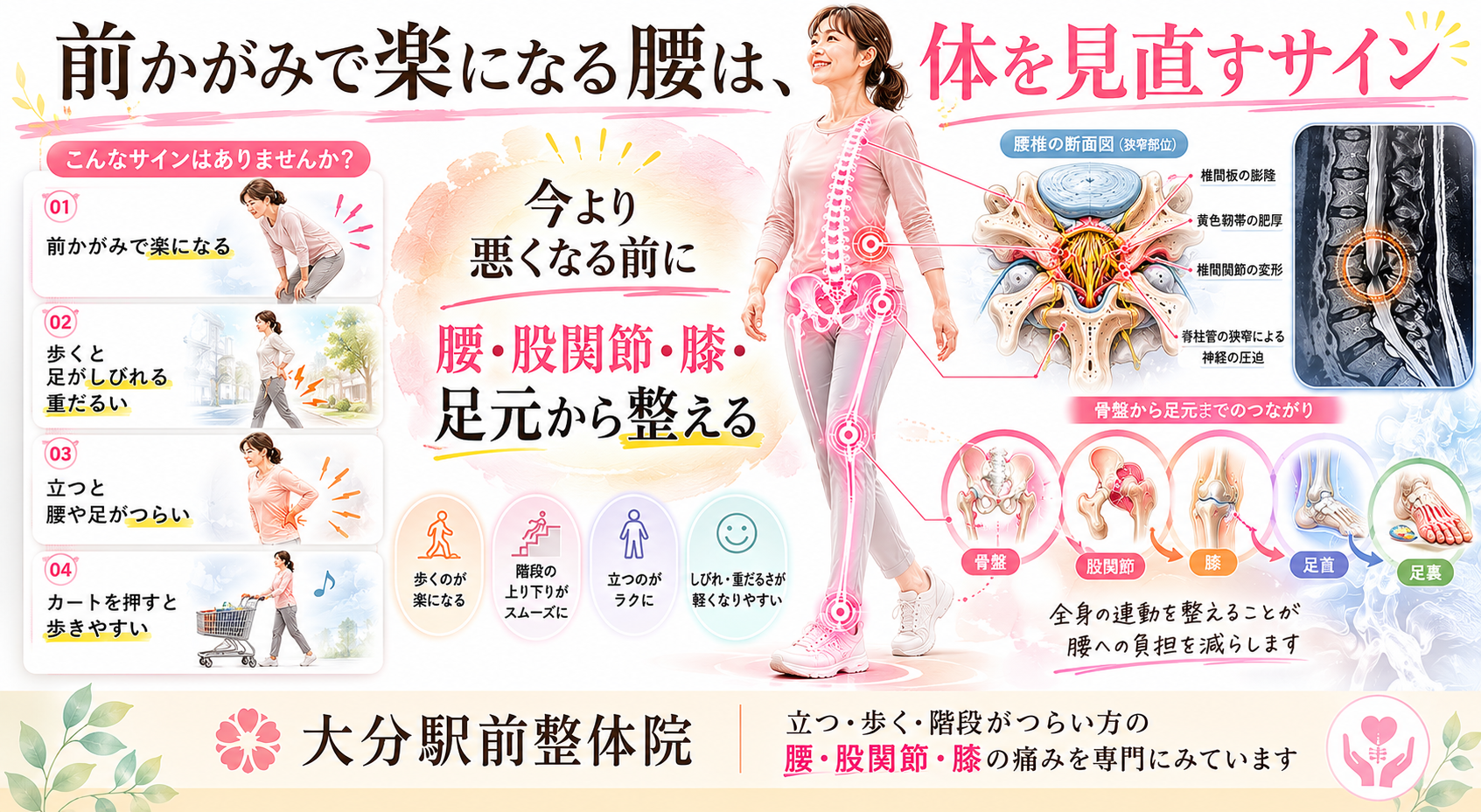 脊柱管狭窄症で前かがみが楽、歩くとしびれる人に向けて腰・股関節・膝・足元から整える重要性を示したまとめ図解