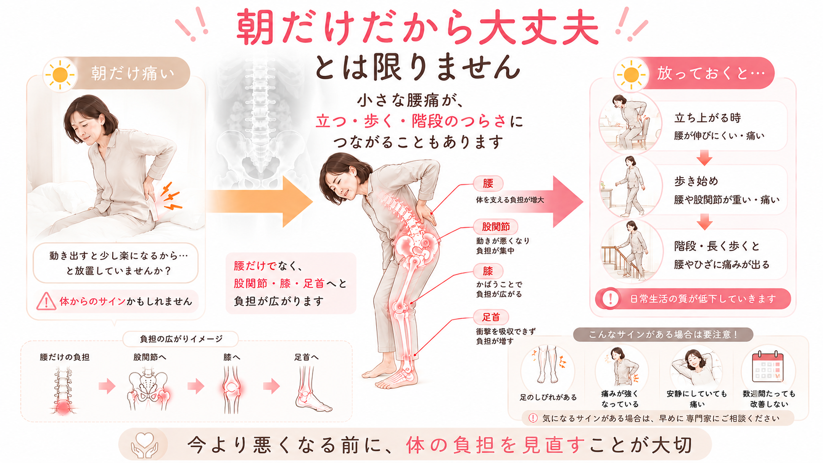 朝だけの腰痛が、立ち上がり・歩き始め・階段のつらさへ広がる可能性を示した医学的図解