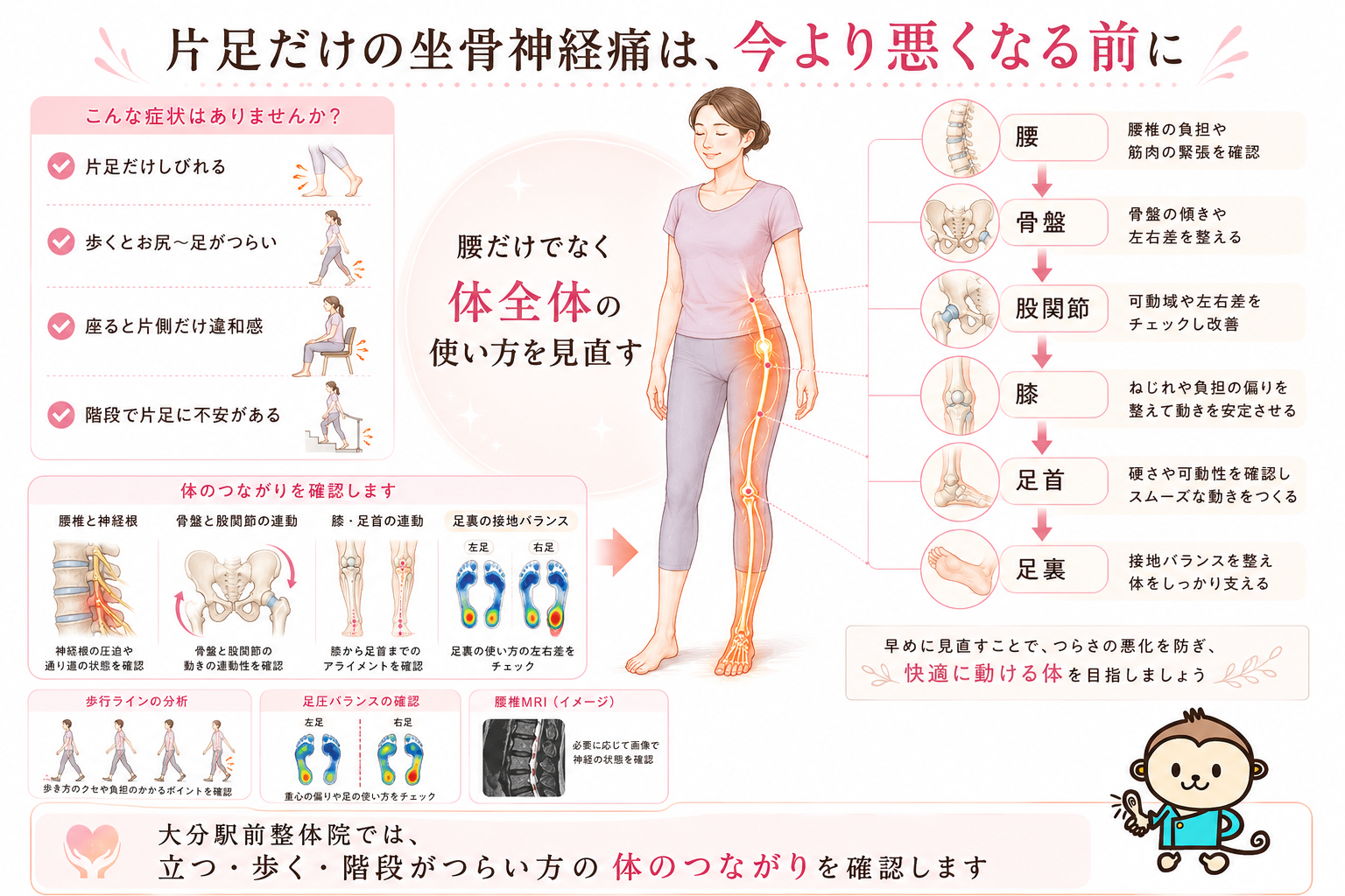 片足だけの坐骨神経痛を今より悪くなる前に腰・骨盤・股関節・膝・足裏から見直す大分駅前整体院のまとめ図解