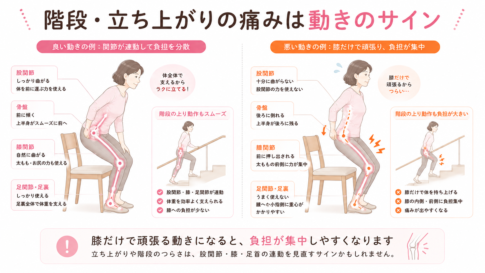階段や立ち上がりで膝が痛い人に多い、股関節・膝・足首の連動不足と膝への負担集中を比較した図解