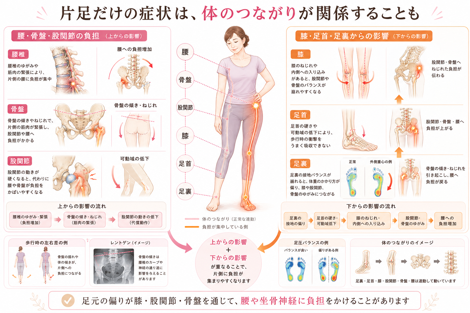 腰・骨盤・股関節・膝・足首・足裏のつながりから片側だけに負担が集まる仕組みを解説した整体院向け医学図解
