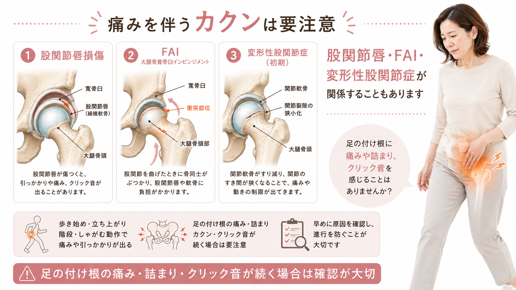 痛みを伴う股関節のカクンについて、股関節唇損傷・FAI・変形性股関節症の可能性を図解した画像