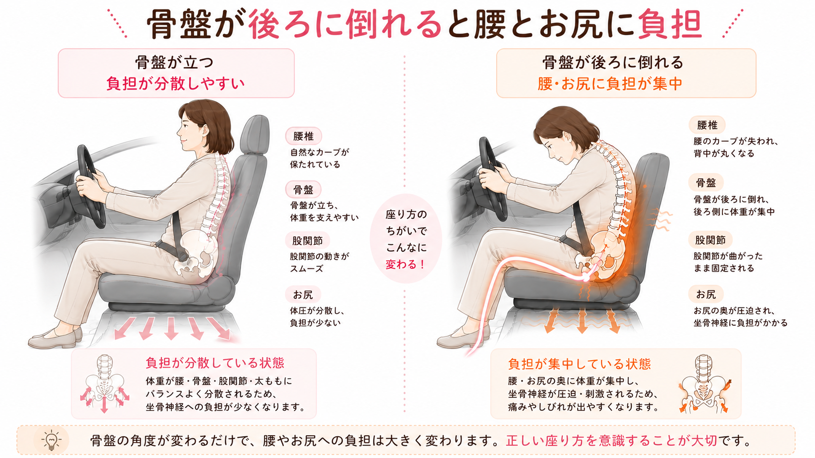 骨盤が立った座り方と骨盤が後ろに倒れた座り方を比較し、腰とお尻への負担の違いを説明した図解