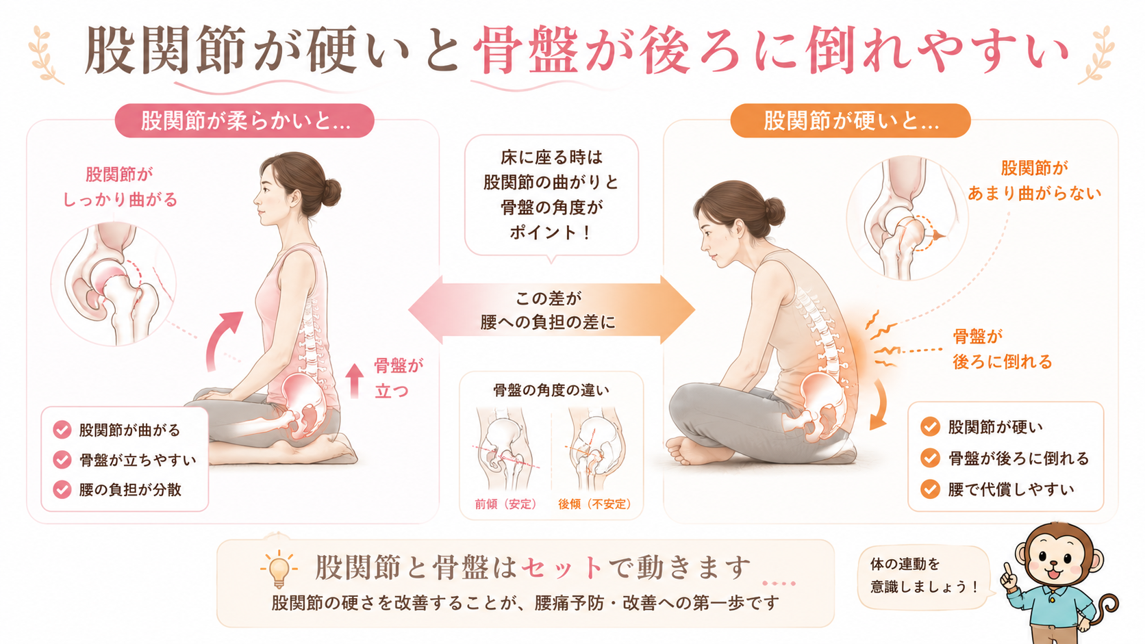股関節が柔らかい場合と硬い場合を比較し、股関節の曲がりと骨盤の後傾、腰への負担の関係を解説した画像
