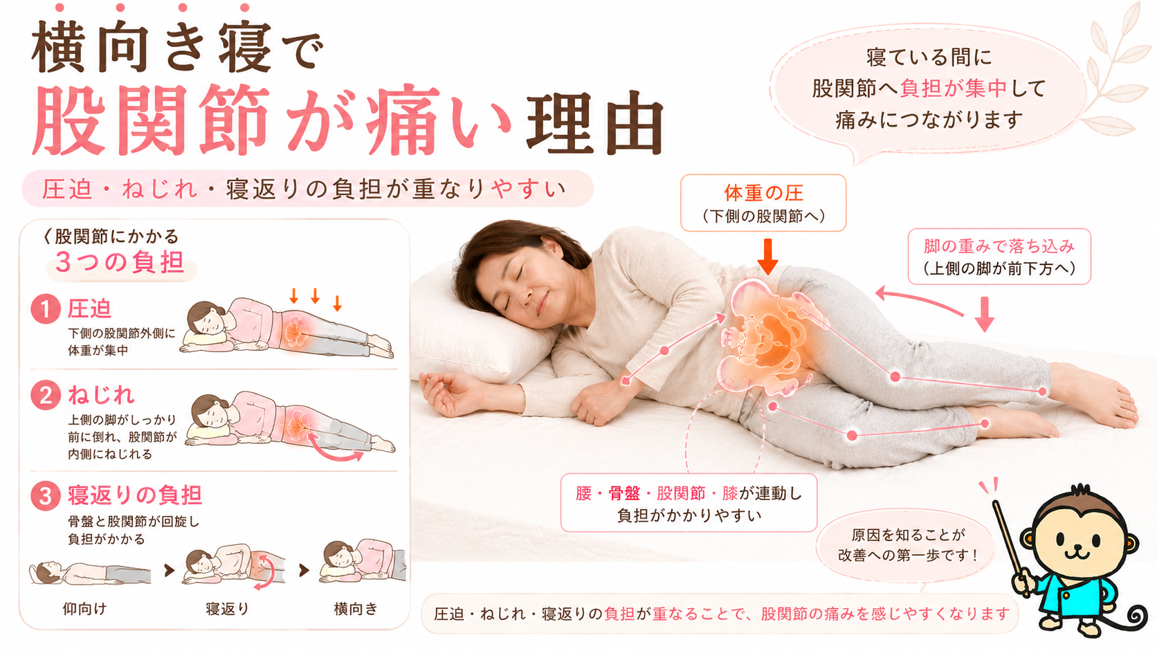 横向き寝で股関節に圧迫・ねじれ・寝返りの負担が重なり痛みにつながる仕組みを解説した図解画像