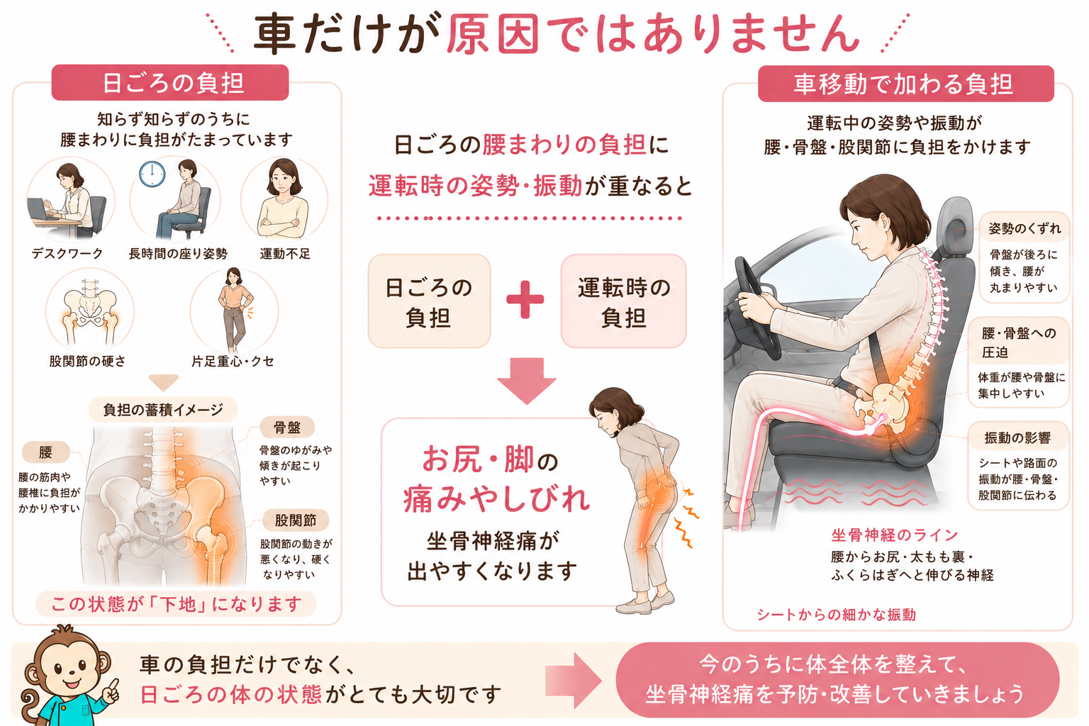 日ごろの腰まわりの負担に車移動の姿勢や振動が重なり坐骨神経痛が出やすくなる流れを説明した図解