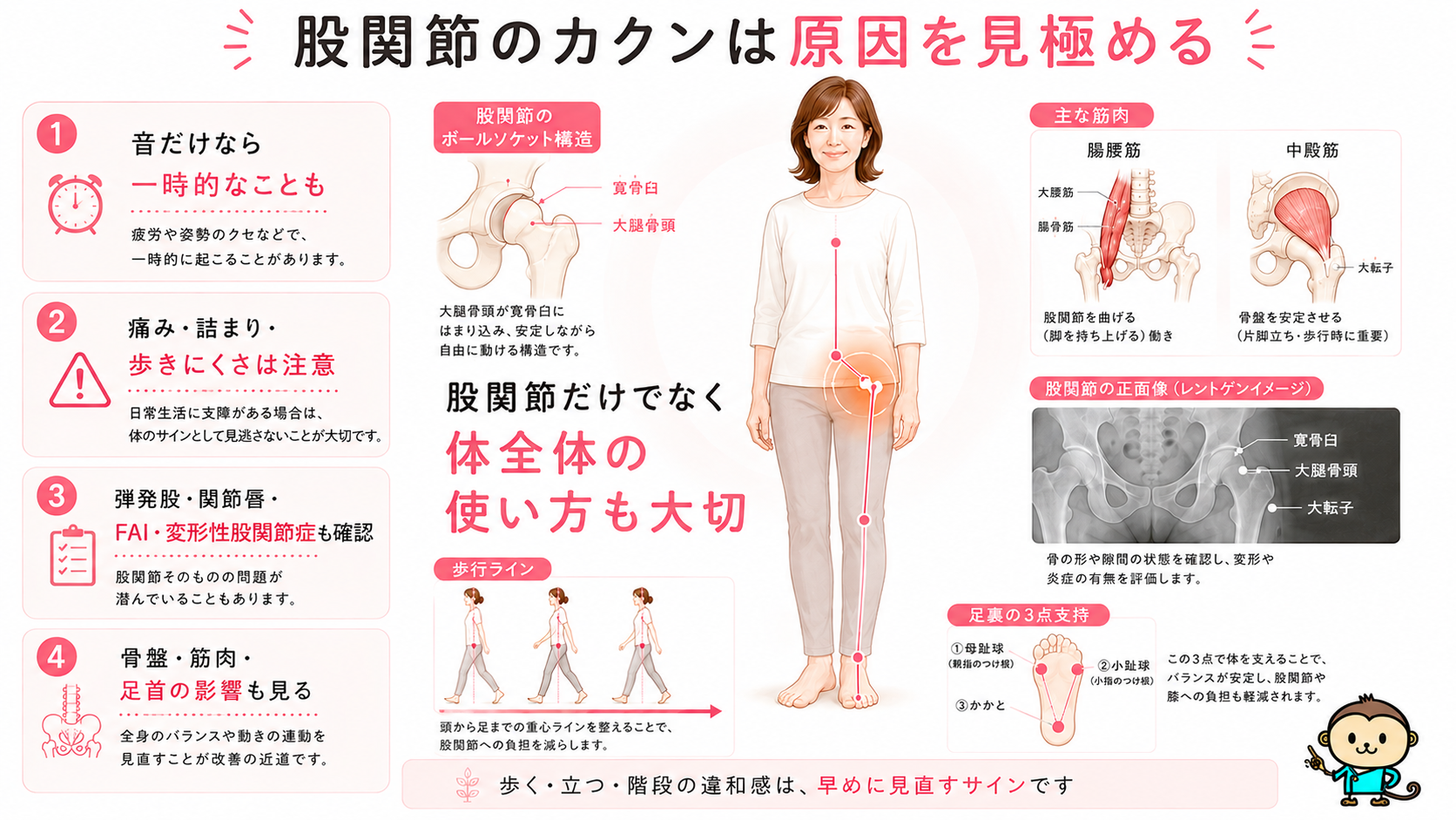 股関節がカクンとなる症状を、股関節だけでなく骨盤・筋肉・足首・歩き方から見直す重要性をまとめた画像