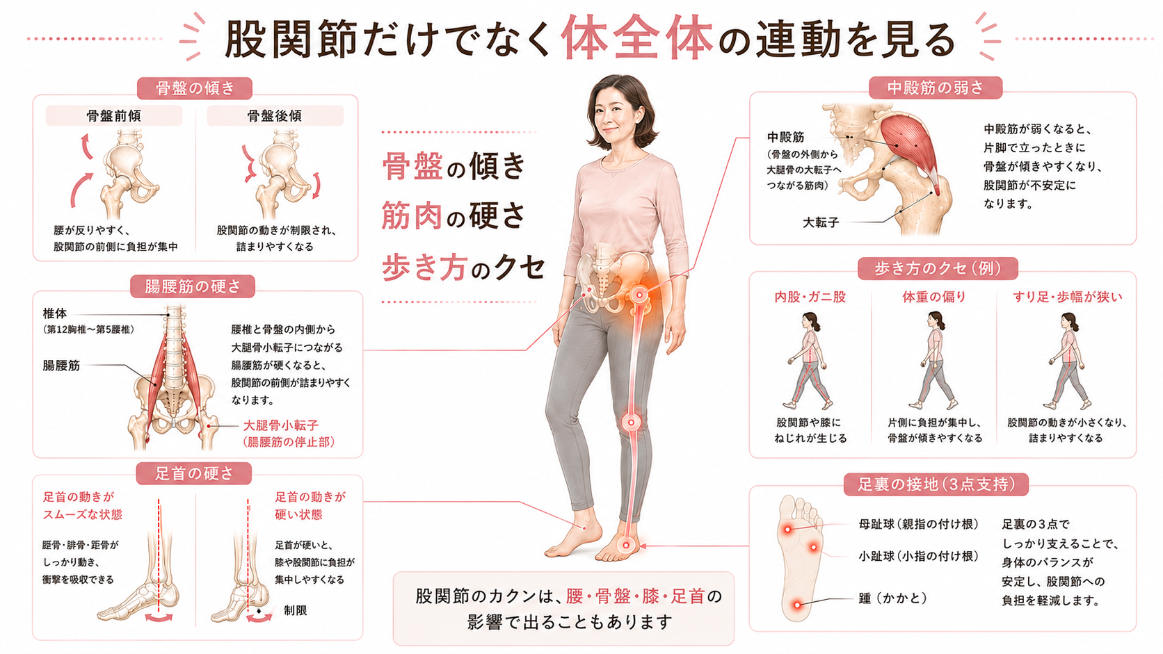股関節の引っかかりや詰まりを、骨盤の傾き・腸腰筋・中殿筋・足首・足裏の連動から説明した整体図解画像