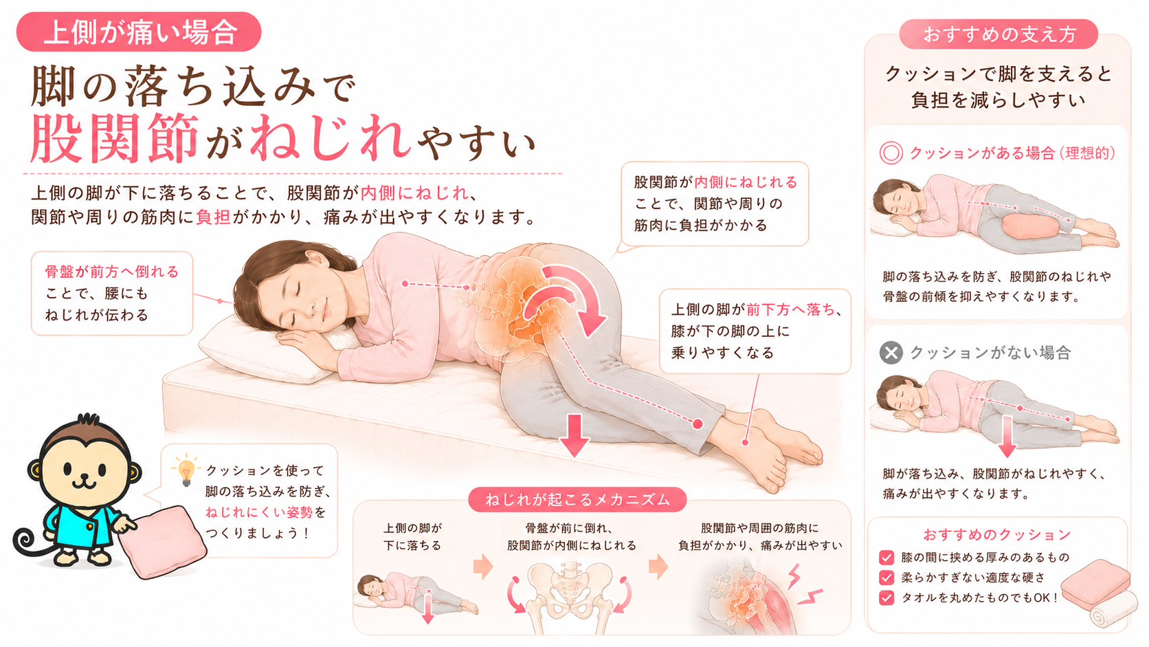 横向き寝で上側の脚が前下方へ落ち、股関節が内側にねじれて痛みが出やすくなる仕組みを解説した図解画像