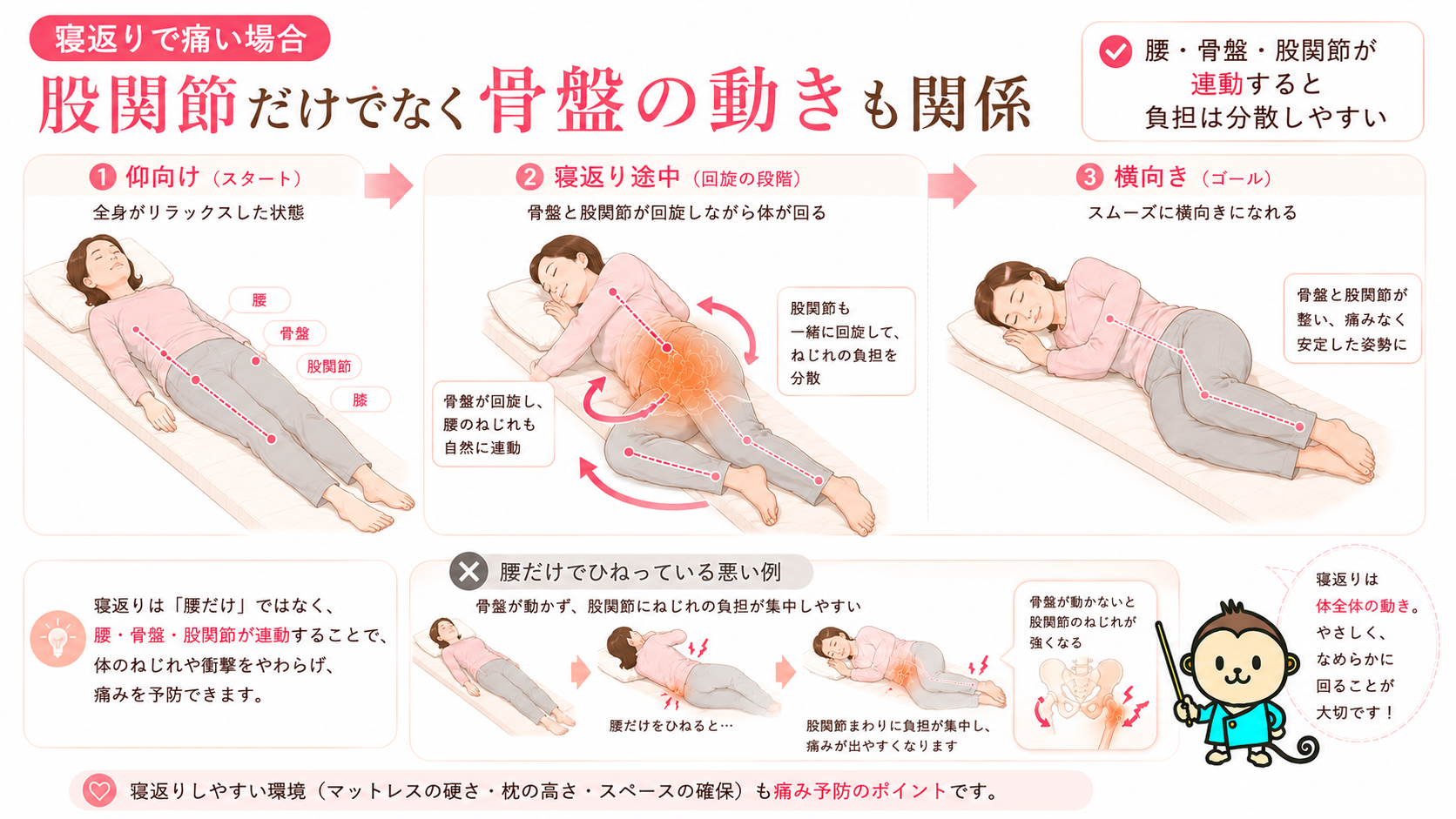寝返りで股関節が痛い原因として、腰・骨盤・股関節が連動せず股関節に負担が集中する仕組みを解説した画像