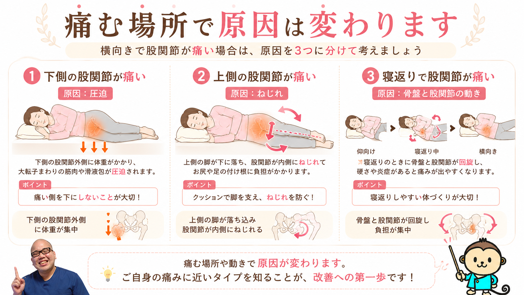 横向きで股関節が痛い原因を下側の圧迫・上側のねじれ・寝返り時の骨盤と股関節の動きに分類した図解画像