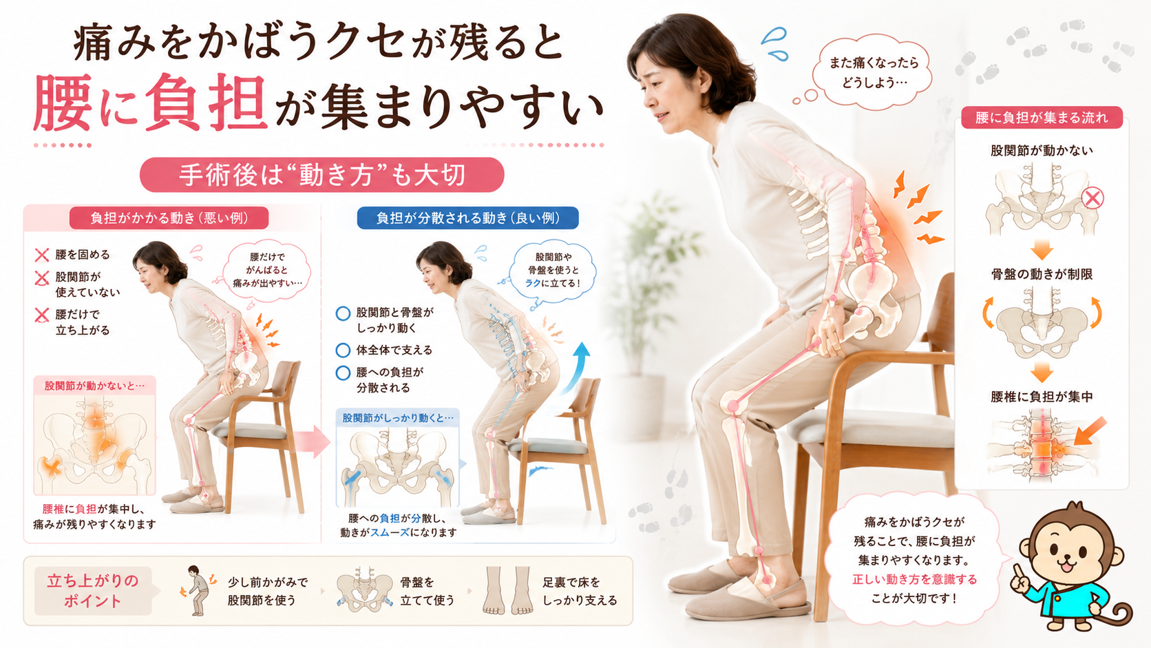 椎間板ヘルニア手術後に腰をかばう動きが残り、腰への負担が集まりやすくなることを示す動作図解