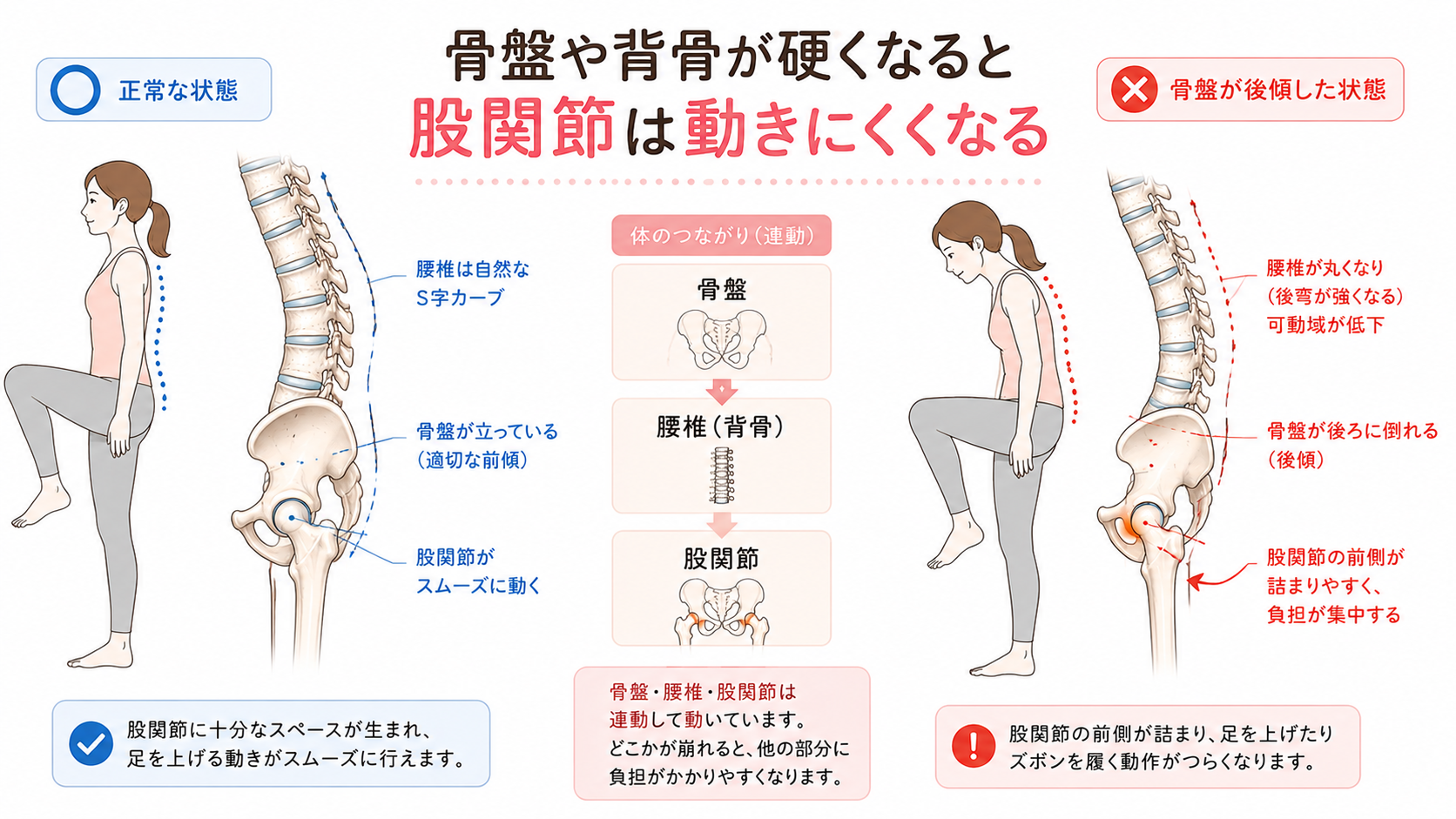 骨盤が立った正常姿勢と骨盤後傾で腰椎が丸くなった姿勢を比較し、股関節の動きやすさを説明した画像