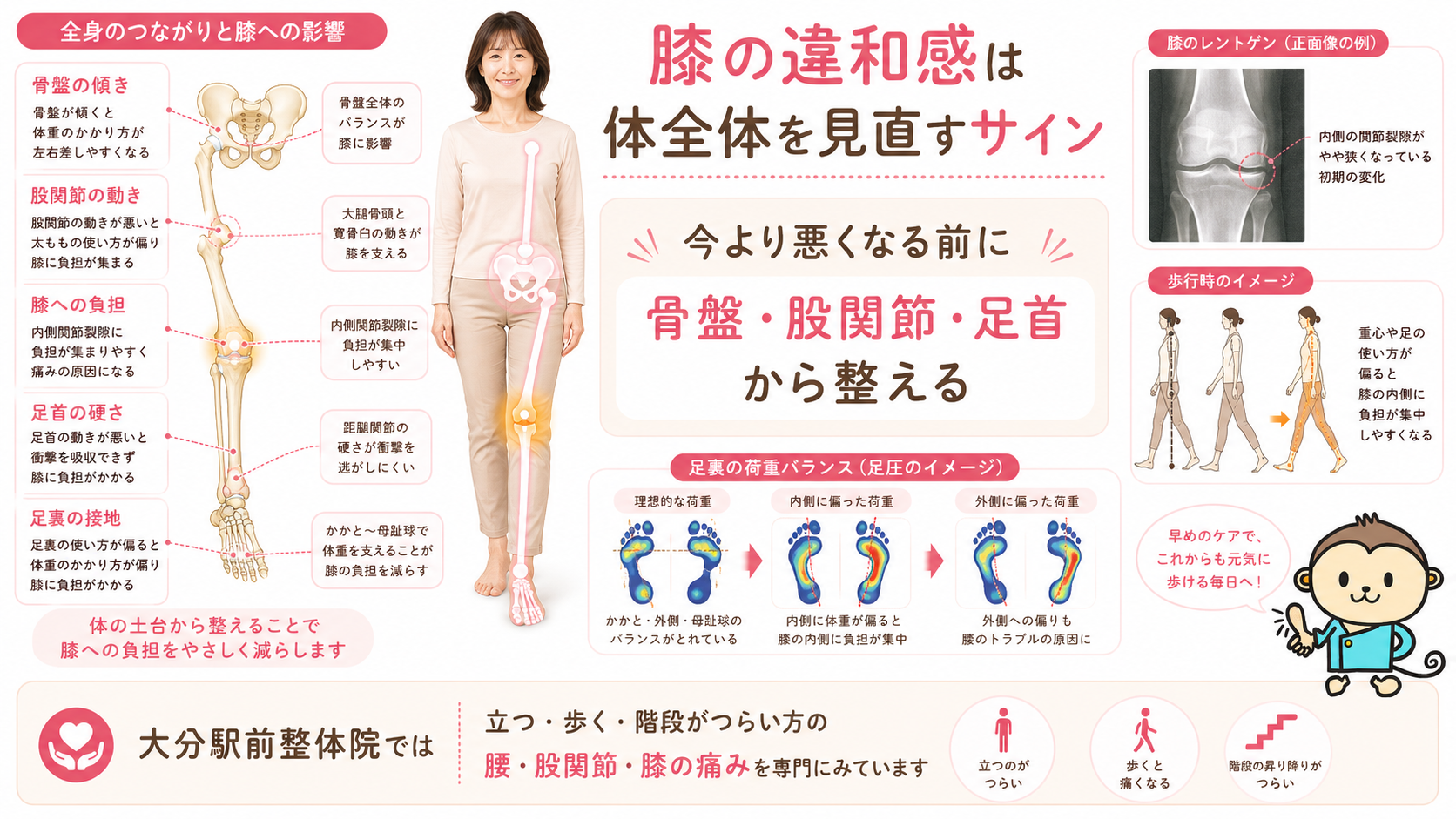 変形性膝関節症の初期症状を膝だけでなく骨盤、股関節、足首、足裏から見直す大分駅前整体院のまとめ画像