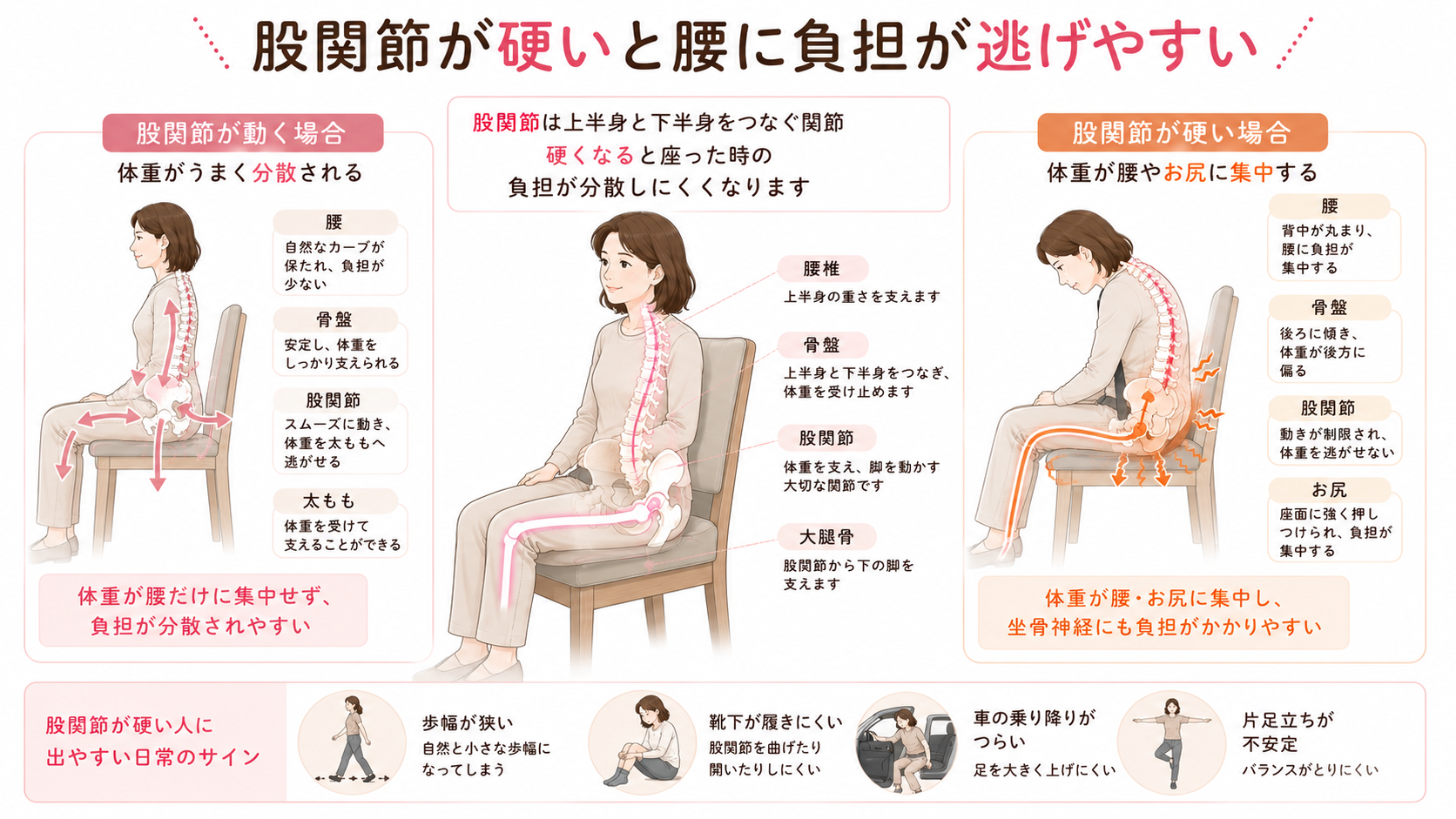 股関節が動く場合と硬い場合で、座った時の体重分散や腰への負担が変わることを説明した医学図解