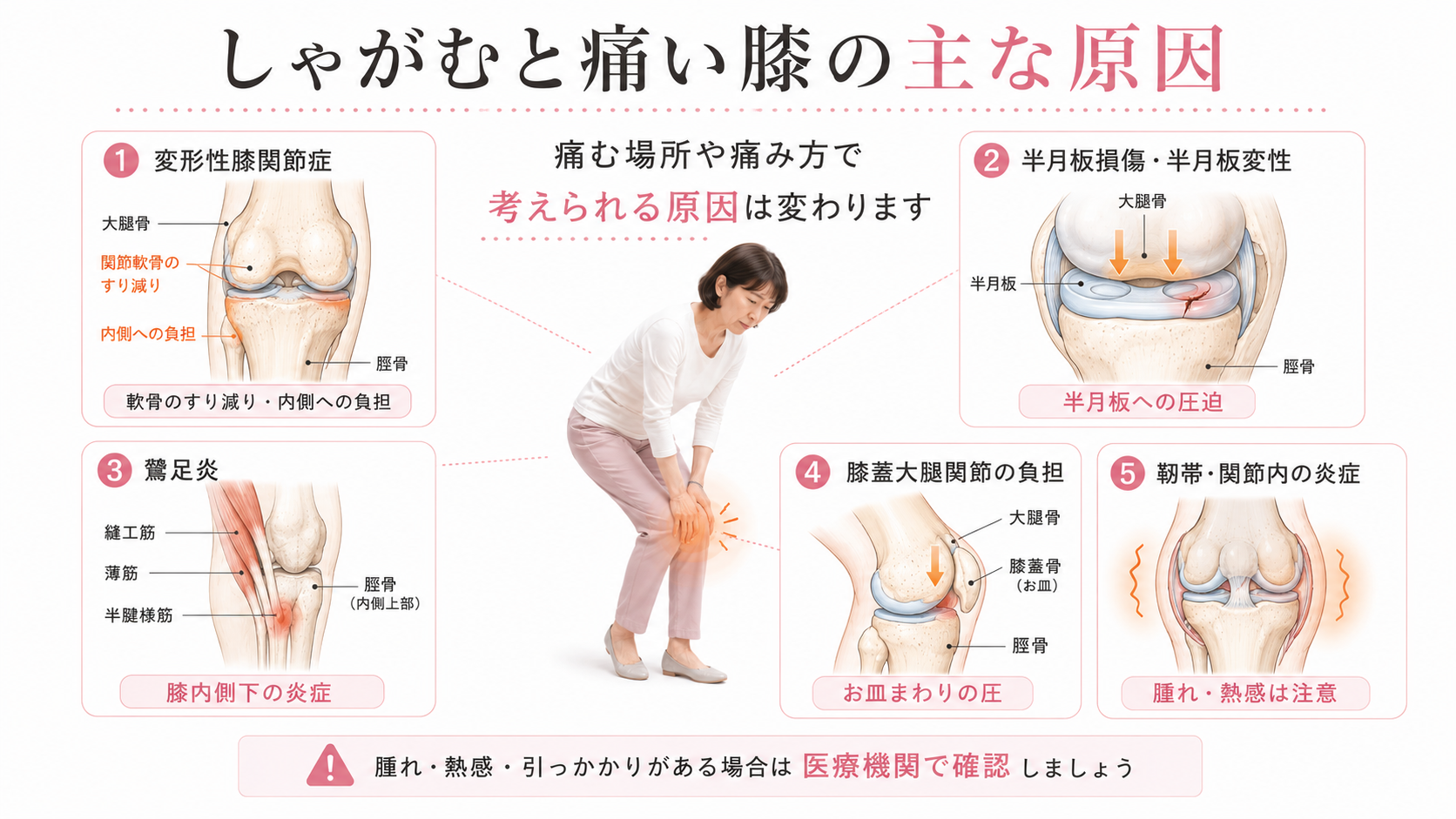 しゃがむと膝が痛い原因として変形性膝関節症・半月板損傷・鵞足炎・膝蓋大腿関節の負担を解説した図解