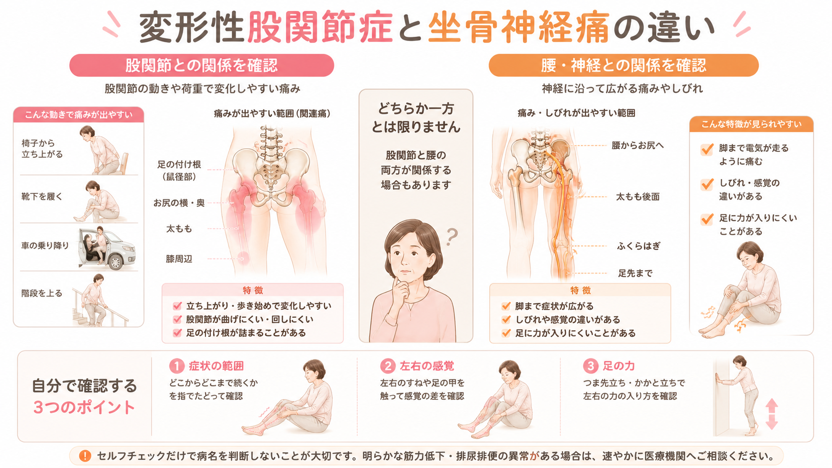 変形性股関節症による関連痛と、腰から坐骨神経に沿って脚へ広がる痛みやしびれの特徴を比較した図解