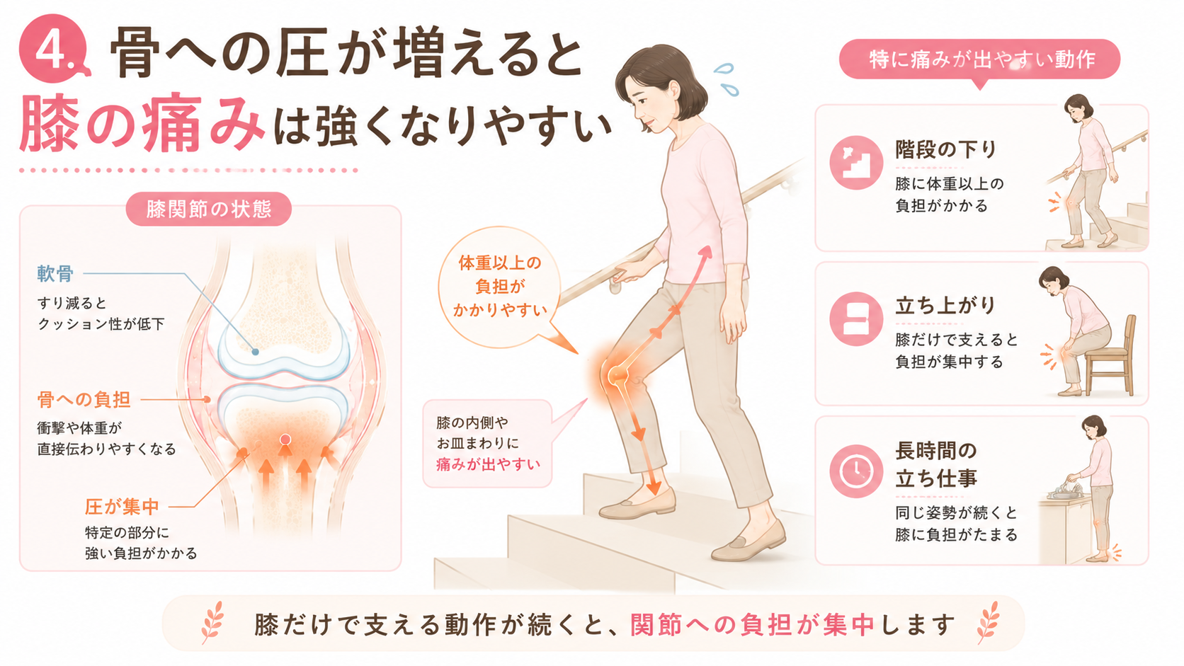 階段を下りる女性と膝関節の図解で、骨への圧が増えると膝の痛みが強くなりやすいことを説明する画像