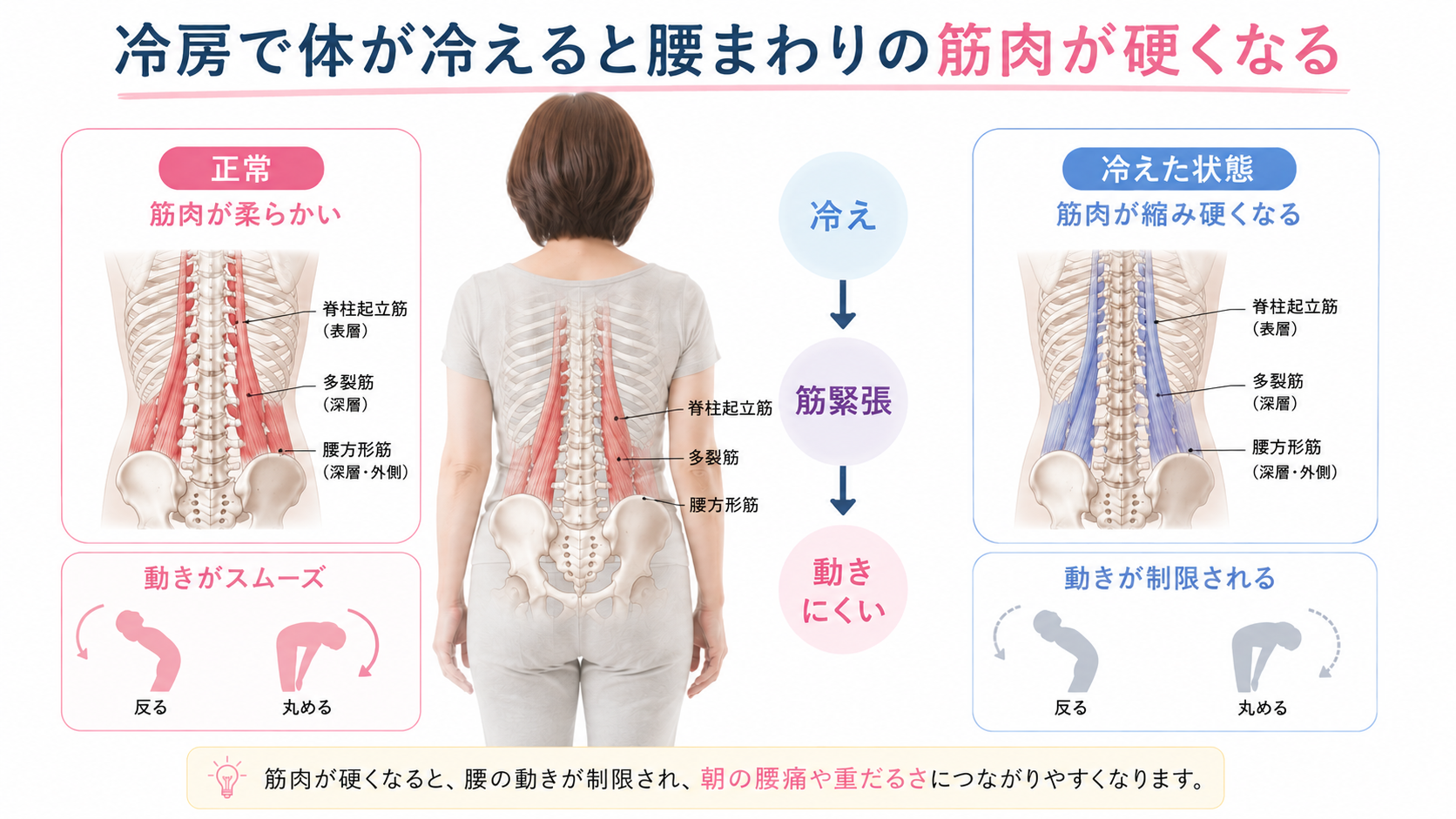 冷房で腰まわりの脊柱起立筋・多裂筋・腰方形筋が硬くなり、腰の動きが制限される様子を示した解剖図