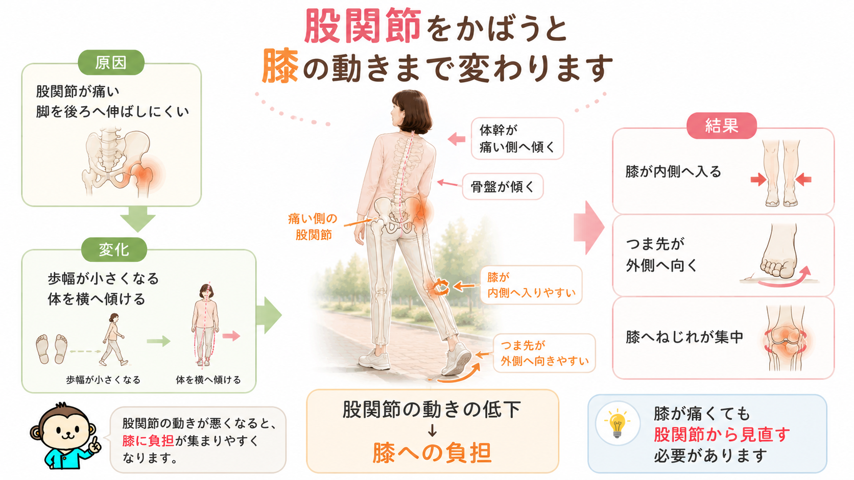 股関節の痛みで体幹や骨盤が傾き、歩幅が小さくなって膝が内側へ入り、ねじれの負担が集中する流れを示した図