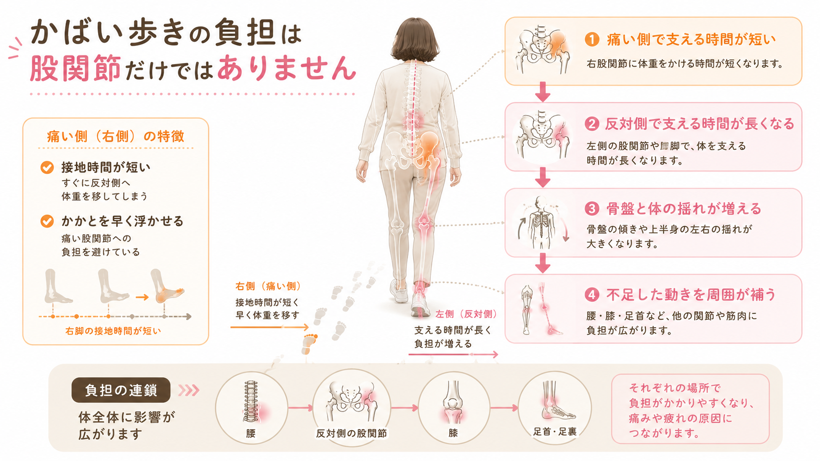 右股関節をかばることで左脚の支持時間が増え、腰・反対側の股関節・膝・足首へ負担が広がる流れの図解