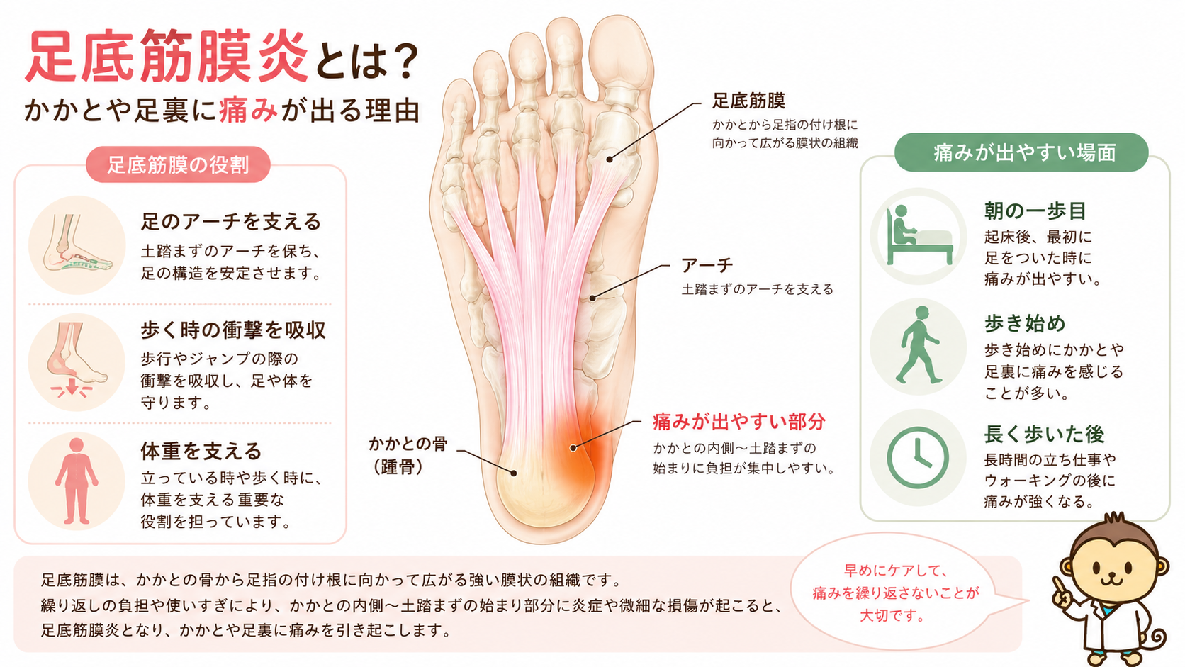 足底筋膜の位置と役割、かかとや土踏まずに痛みが出やすい理由を医学的に解説した足裏図