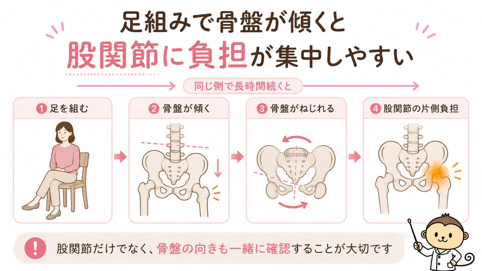足組みから骨盤の傾き、骨盤のねじれ、股関節の片側負担へつながる流れを4段階で示した図解画像