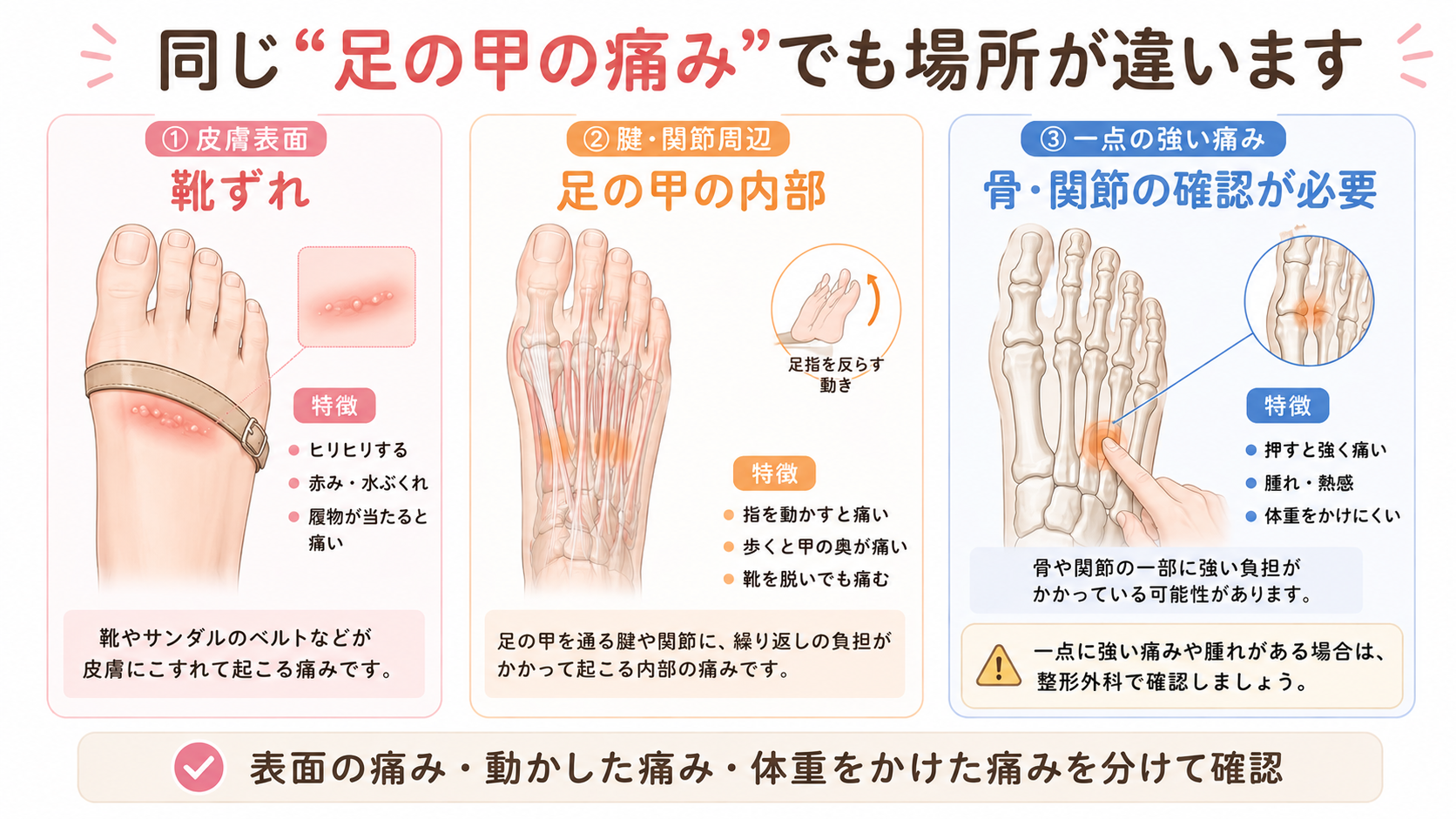 足の甲の痛みを、皮膚表面の靴ずれ、腱や関節周辺の内部痛、一点に集中する骨周辺の痛みに分けた比較図