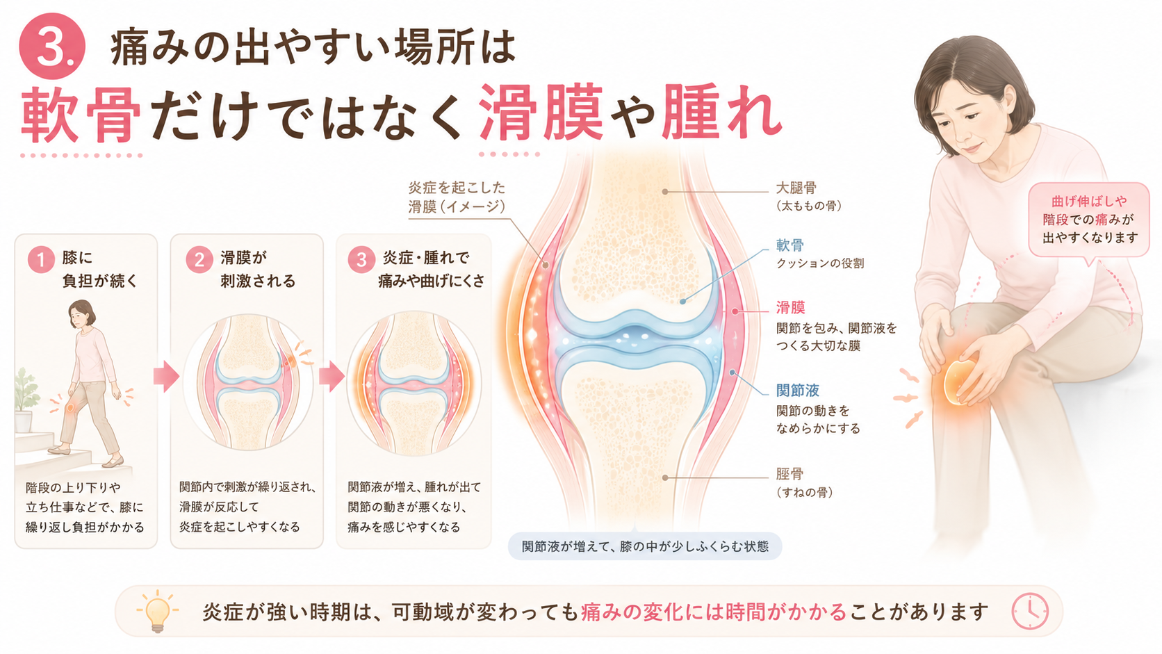 膝の滑膜炎や関節内の腫れが痛みや曲げにくさにつながる流れを説明する膝関節図解