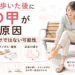 旅行で歩いた後に足の甲が痛い原因｜靴ずれだけではない可能性