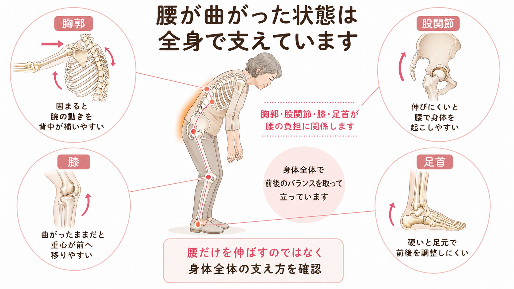 腰が曲がった姿勢を胸郭、股関節、膝、足首を含む身体全体で支えている図解