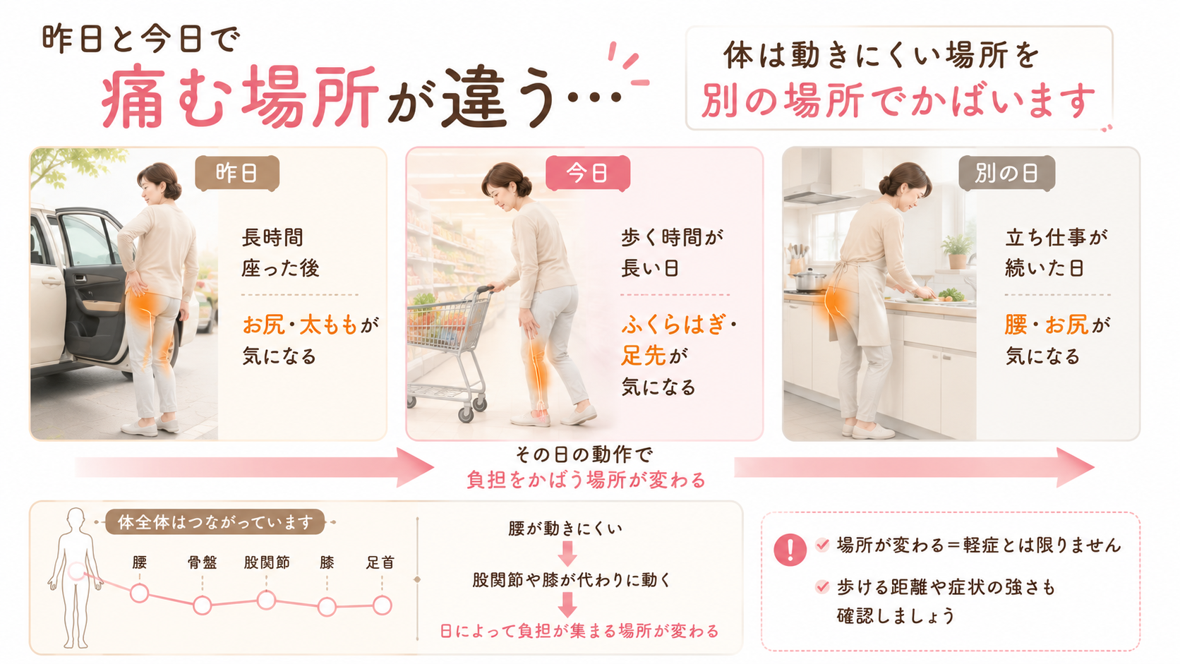 車移動、買い物、台所仕事によってお尻、ふくらはぎ、腰など痛みやしびれの場所が日ごとに変わる女性