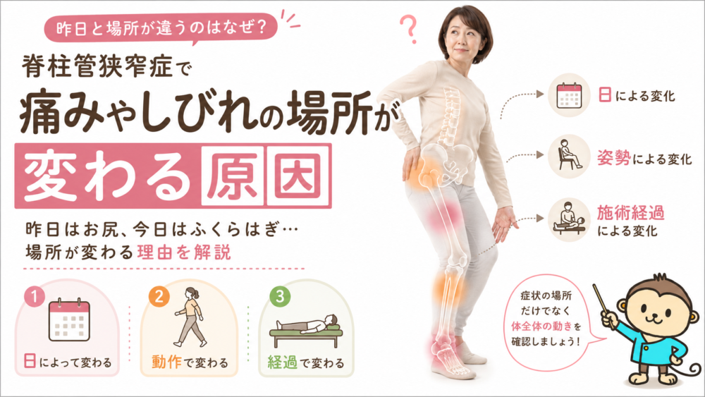 脊柱管狭窄症で痛みやしびれの場所が変わる原因