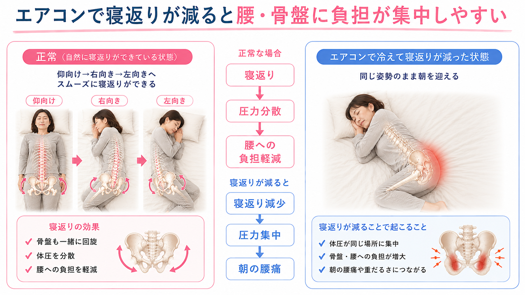 寝返りができる状態と、冷えで寝返りが減り腰・骨盤に負担が集中する状態を比較した解説画像